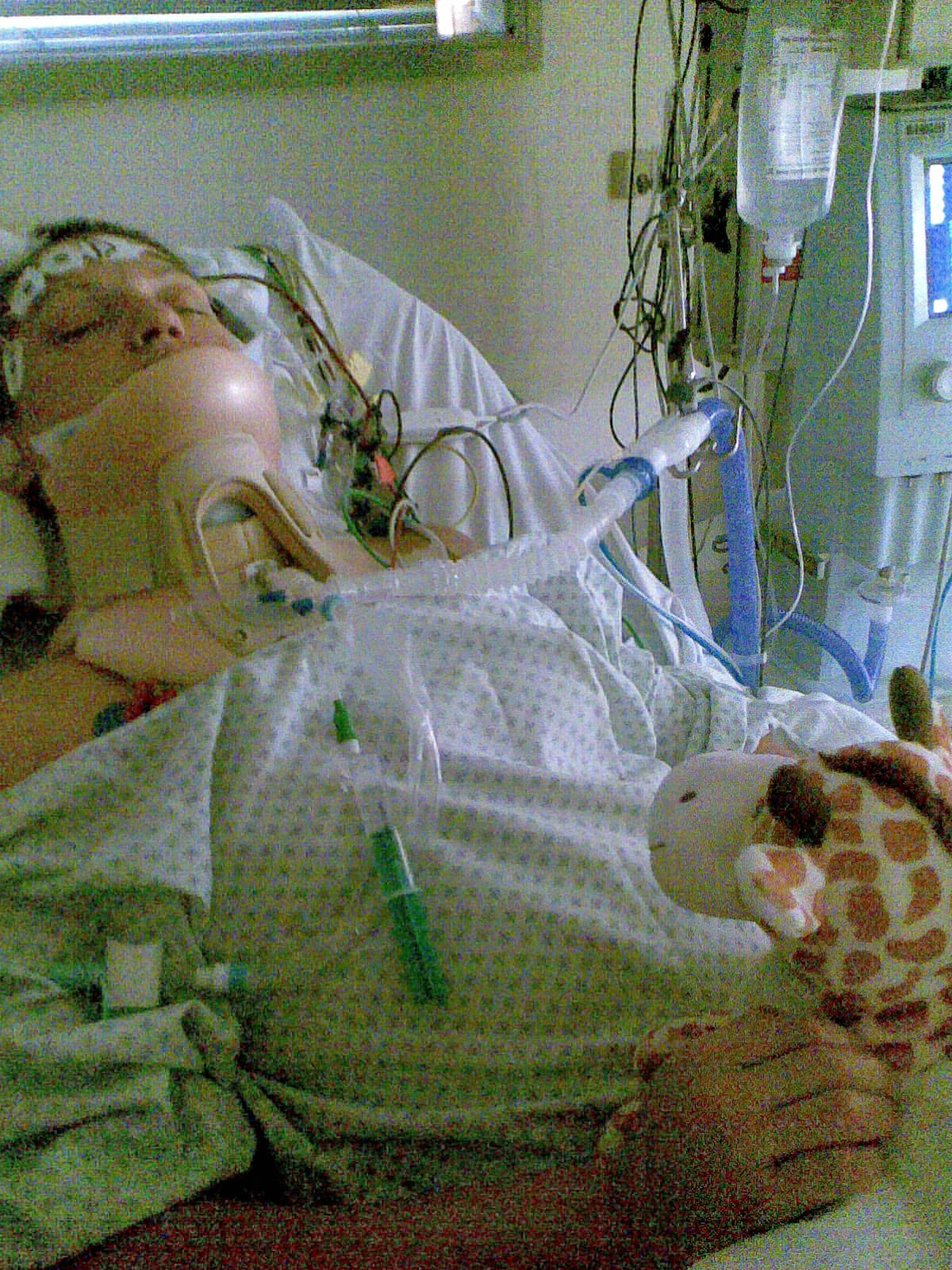 After the accident — induced coma, our hardest time.