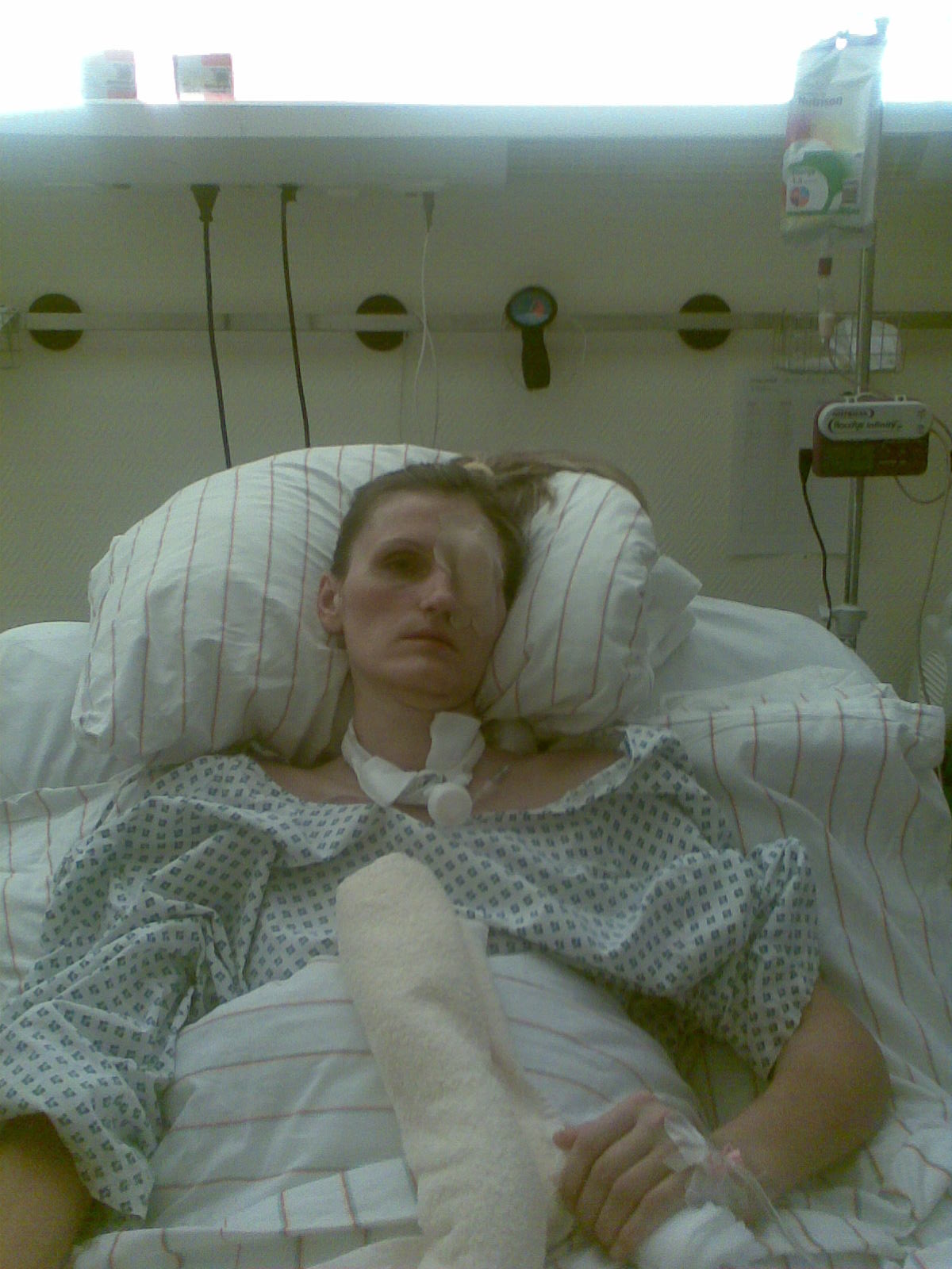 Yuliya in a minimally conscious state — hospital photo.
