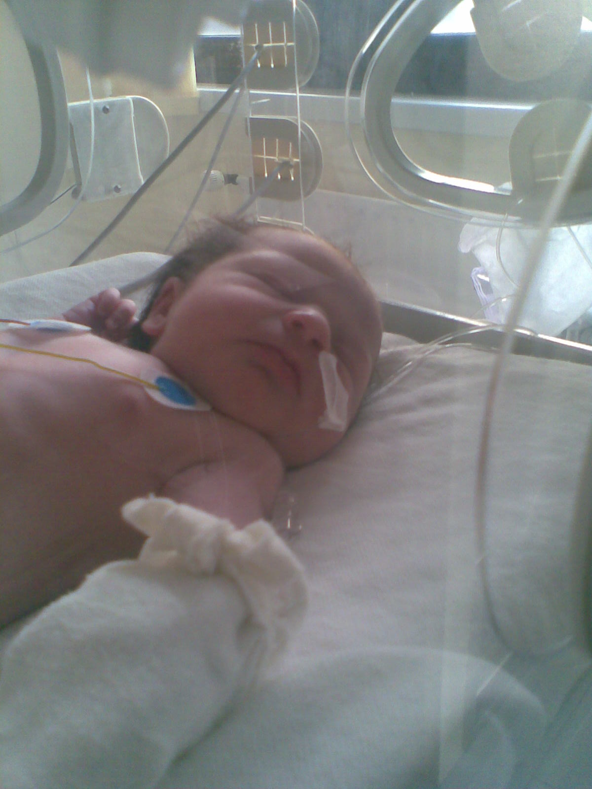 Lena’s birth (ICU)